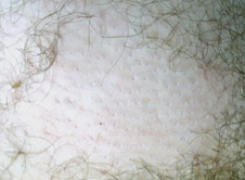 Kiva Teplý epilační vosk 1000g - kiva_vosk_odstranene_chlupy