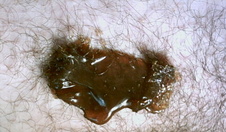 Kiva Teplý epilační vosk 3x 250g sleva 10 procent - kiva_vosk_naneseny