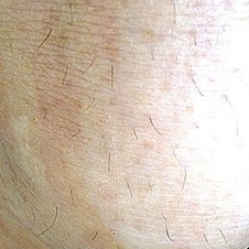 Kiva Teplý epilační vosk 3x 250g sleva 10 procent - kiva_vosk_po_opakovane_aplikaci